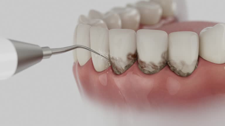 Trusted Tooth Extraction service in Houma, LA - Dentist Open Now